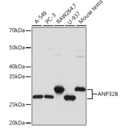 ANP32B Rabbit mAb
