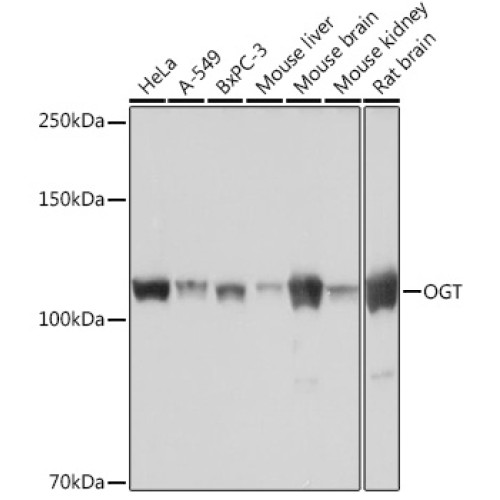 OGT Rabbit mAb