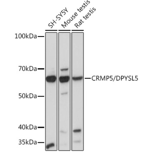 CRMP5/DPYSL5 Rabbit mAb