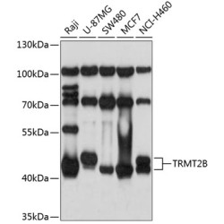 TRMT2B Rabbit pAb