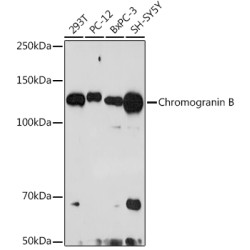 Chromogranin B Rabbit mAb