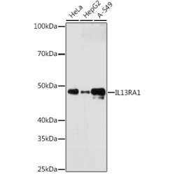 IL13RA1 Rabbit mAb