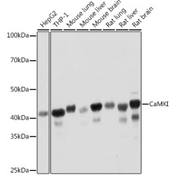 CaMKI Rabbit mAb