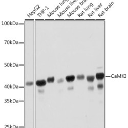 CaMKI Rabbit mAb