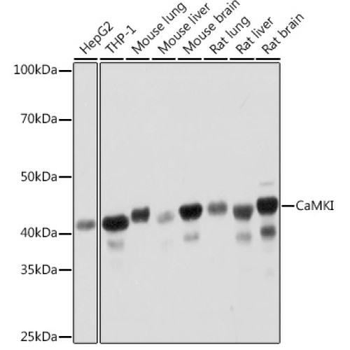 CaMKI Rabbit mAb