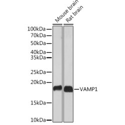VAMP1 Rabbit mAb