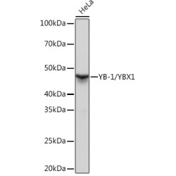 YB-1/YBX1 Rabbit mAb