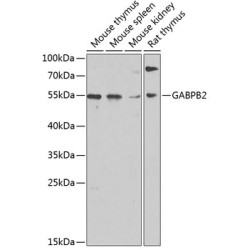 GABPB2 Rabbit pAb