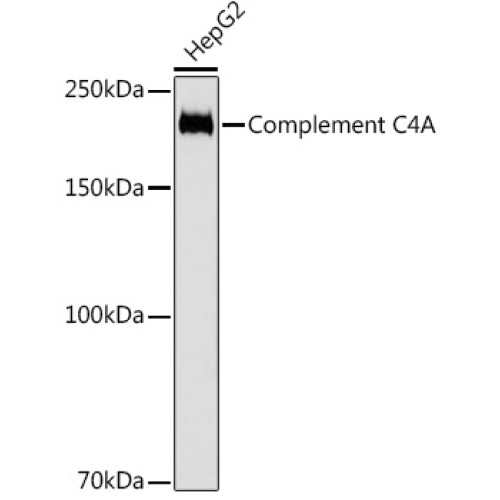 Complement C4A Rabbit mAb