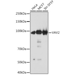 VAV2 Rabbit mAb