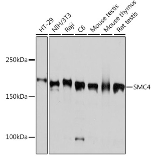 SMC4 Rabbit mAb