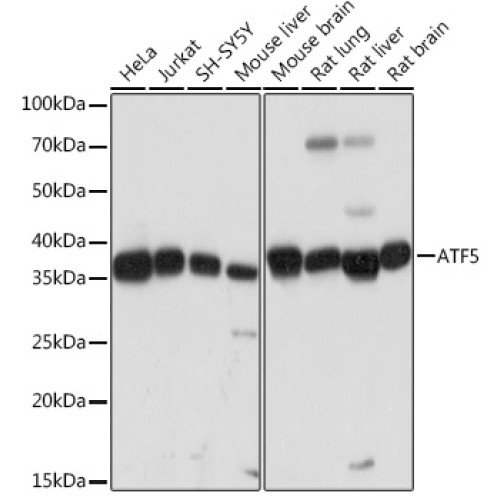 ATF5 Rabbit mAb