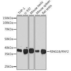 RING1B/RNF2 Rabbit mAb