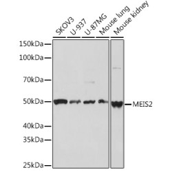 MEIS2 Rabbit mAb