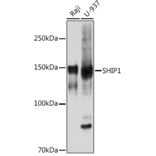 SHIP1 Rabbit mAb