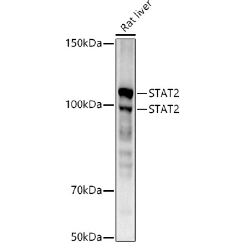 [KD Validated] STAT2 Rabbit mAb