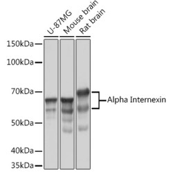 Alpha Internexin Rabbit mAb