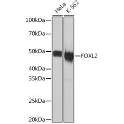 FOXL2 Rabbit mAb