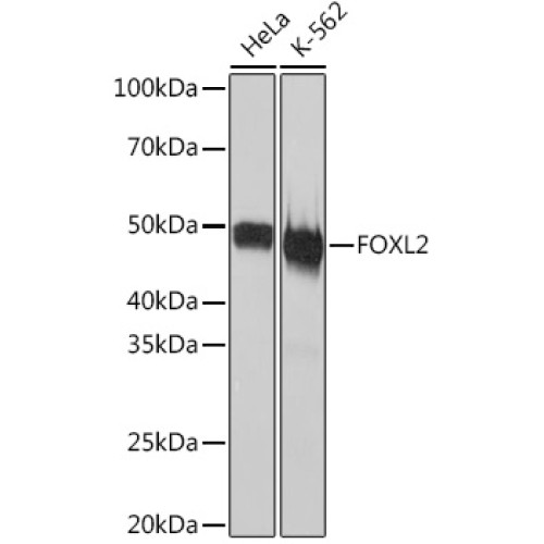 FOXL2 Rabbit mAb