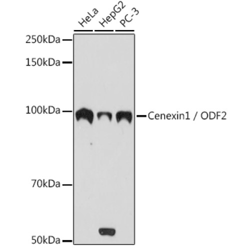 Cenexin1 / ODF2 Rabbit mAb