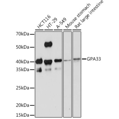 GPA33 Rabbit mAb