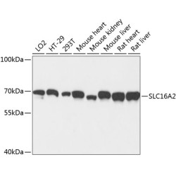 SLC16A2 Rabbit pAb