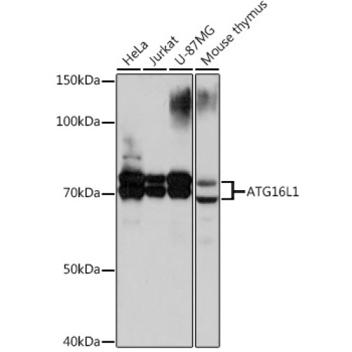 [KO Validated] ATG16L1 Rabbit mAb