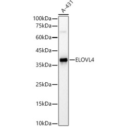 ELOVL4 Rabbit pAb