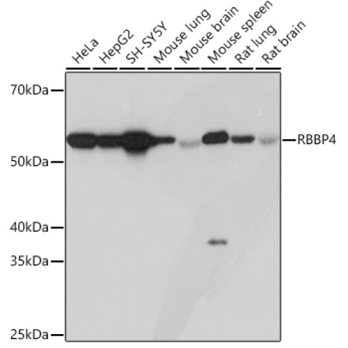 RBBP4 Rabbit mAb