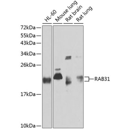 RAB31 Rabbit pAb