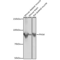 PFKM Rabbit mAb