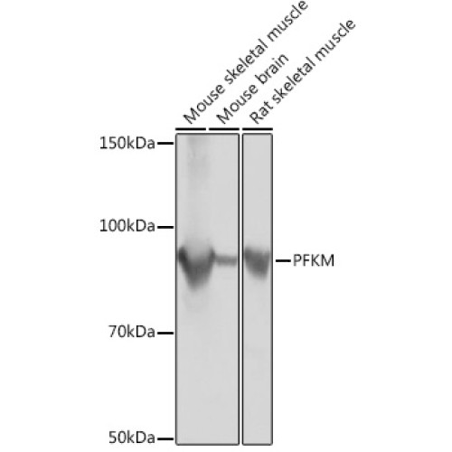 PFKM Rabbit mAb