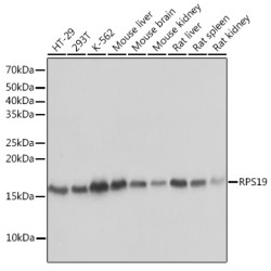 RPS19 Rabbit mAb