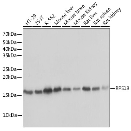RPS19 Rabbit mAb