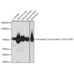 Guanylyl Cyclase beta 1 (GUCY1B3) Rabbit mAb