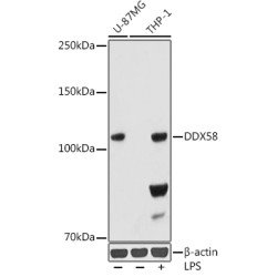Rig-I/DDX58 Rabbit mAb