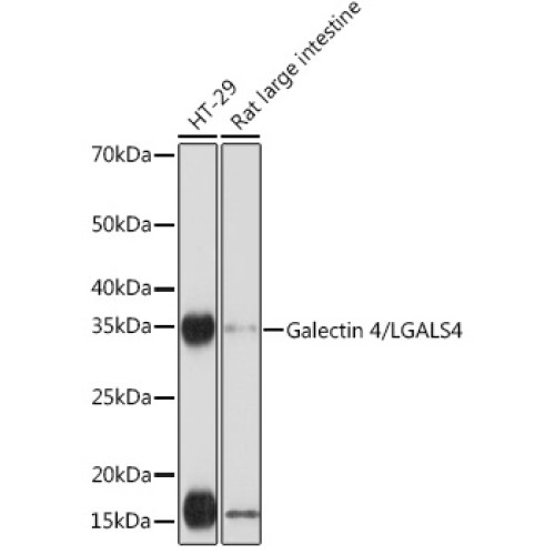 Galectin 4/LGALS4 Rabbit mAb