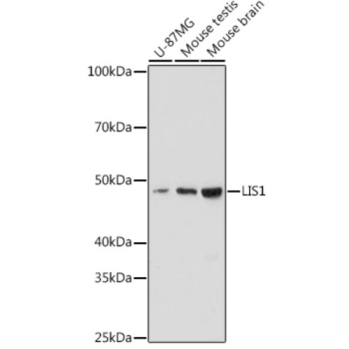 LIS1 Rabbit mAb