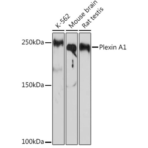 Plexin A1 Rabbit mAb