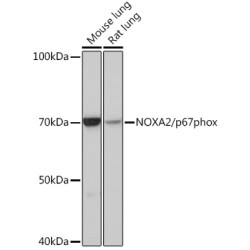 NOXA2/p67phox Rabbit mAb