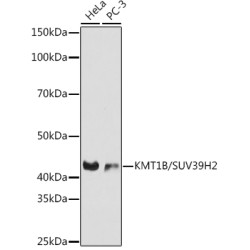 KMT1B / SUV39H2 Rabbit mAb