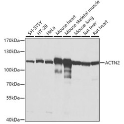 ACTN2 Rabbit pAb