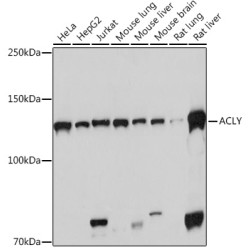 [KO Validated] ACLY Rabbit mAb