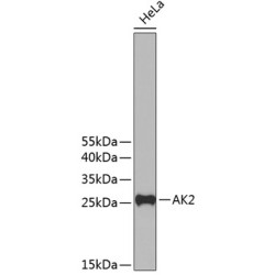 AK2 Rabbit pAb