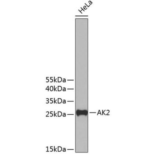 AK2 Rabbit pAb