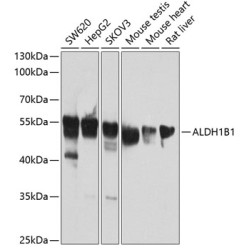 ALDH1B1 Rabbit pAb