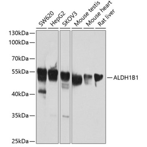 ALDH1B1 Rabbit pAb