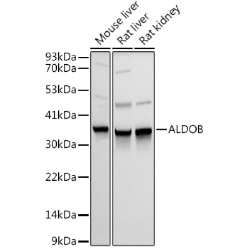 ALDOB Rabbit pAb