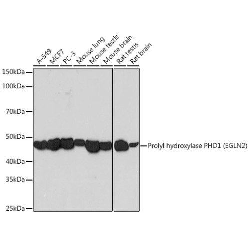Prolyl hydroxylase PHD1 (EGLN2) Rabbit mAb