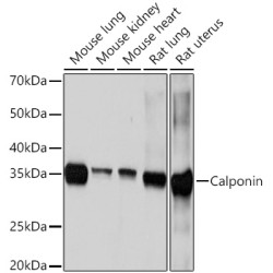 Calponin Rabbit mAb